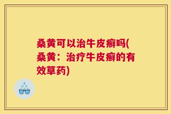 桑黄可以牛皮癣吗(桑黄:牛皮癣的有效草药) 桑黄可以牛皮癣吗(桑黄:牛皮癣的有效草药)